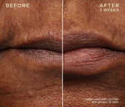 Lip Filler + Refill with Subtopical Plumping Technology™