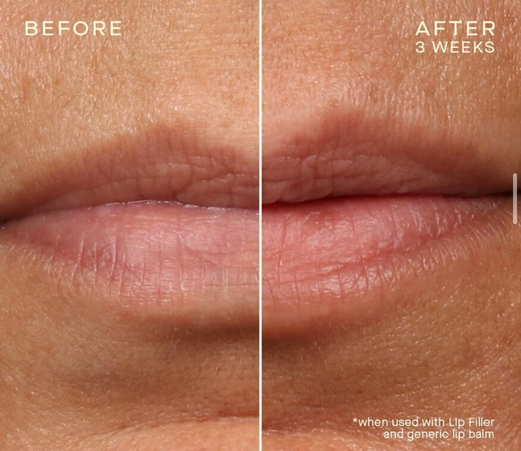Lip Filler + Refill with Subtopical Plumping Technology™